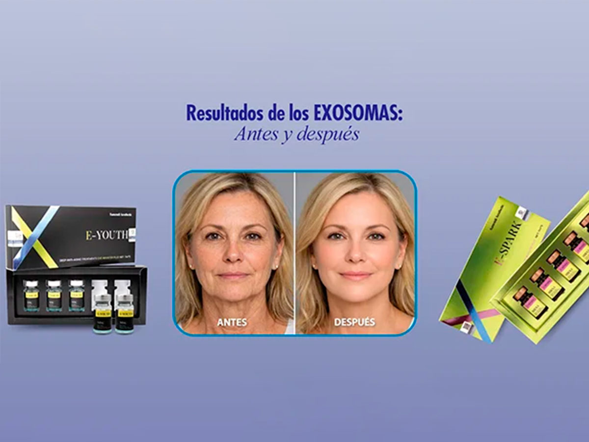 Tratamiento de Exosomas + PDRN